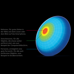 1 Gleitsicht Monatslinse einer neuen Produktgeneration mit 4 Additionen und unterschiedlichen Zonen in/auf der Linse